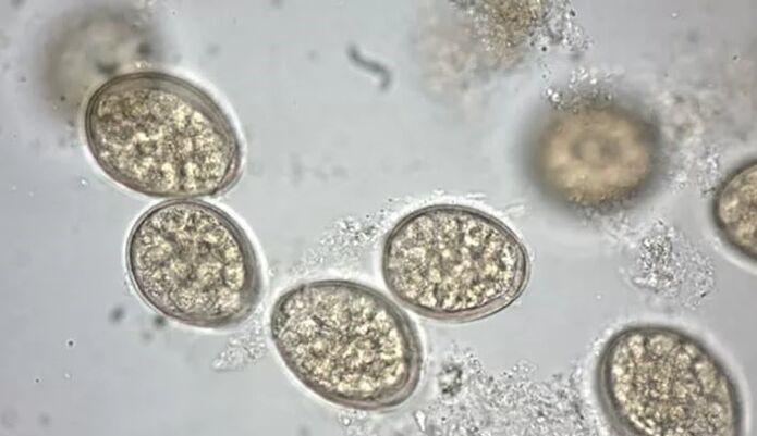 parasit handapeun mikroskop