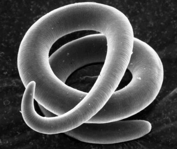 Trichinella handapeun mikroskop